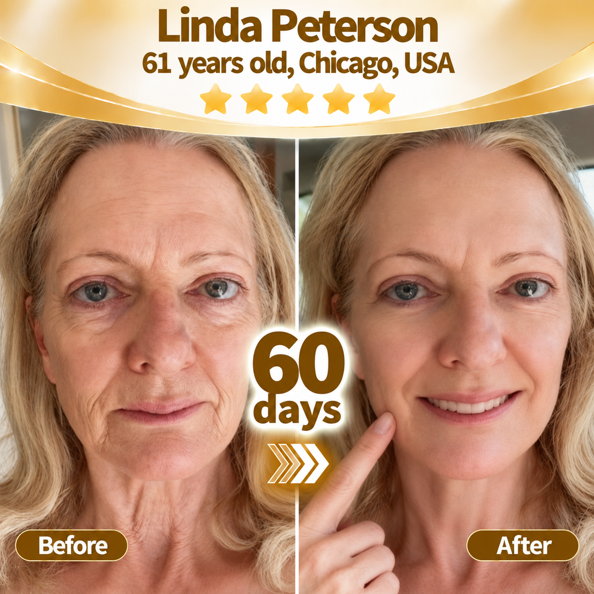 🔥 LAST DAY: 80% OFF |Purelora® Snake Venom Peptide Renewal Serum – Firming, Fine Lines & Visible Marks Care